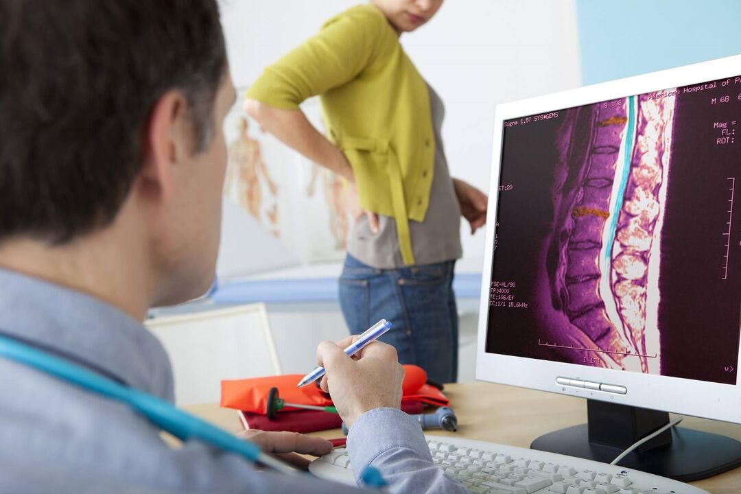 Diagnose einer lumbalen Osteochondrose