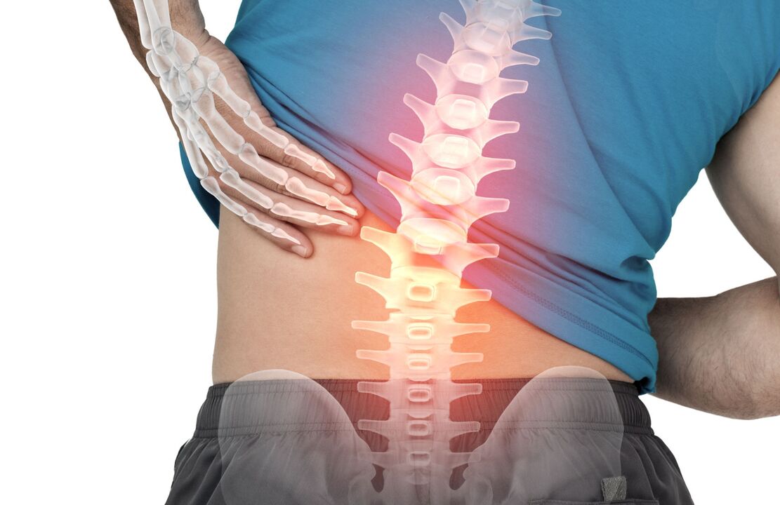 Die Gefahr der Ostechondrose der Lendenwirbelsäule