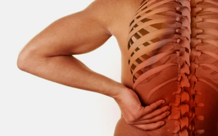 Die Ursachen der Osteochondrose der Lendenwirbelsäule