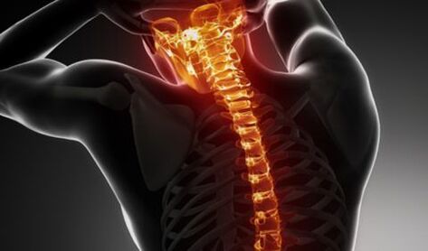 Osteochondrose der gesamten Wirbelsäule