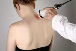 Behandlung der zervikalen Osteochondrose mit Lasertherapie