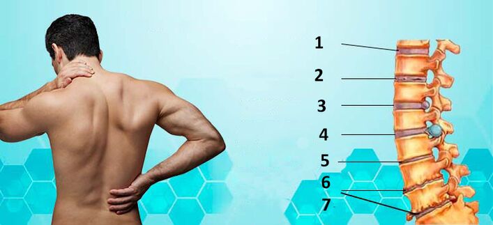 Entwicklungsstadien der Osteochondrose